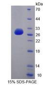CDC27 Protein - Recombinant Cell Division Cycle Protein 27 (CDC27) by SDS-PAGE