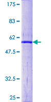 CDC34 Protein - 12.5% SDS-PAGE of human CDC34 stained with Coomassie Blue