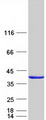 CDC34 Protein - Purified recombinant protein CDC34 was analyzed by SDS-PAGE gel and Coomassie Blue Staining