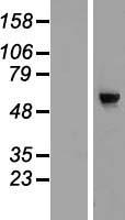 CDC40 Protein - Western validation with an anti-DDK antibody * L: Control HEK293 lysate R: Over-expression lysate
