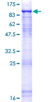 CDC40 Protein - 12.5% SDS-PAGE of human CDC40 stained with Coomassie Blue