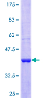 CDC40 Protein - 12.5% SDS-PAGE Stained with Coomassie Blue.
