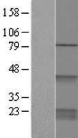 CDC42 Protein - Western validation with an anti-DDK antibody * L: Control HEK293 lysate R: Over-expression lysate