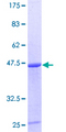 CDC42 Protein - 12.5% SDS-PAGE of human CDC42 stained with Coomassie Blue