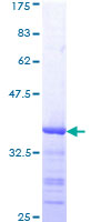 CDC42 Protein - 12.5% SDS-PAGE Stained with Coomassie Blue.