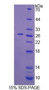 CDC42 Protein - Recombinant Cell Division Cycle Protein 42 By SDS-PAGE