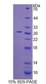 CDC42 Protein - Recombinant Cell Division Cycle Protein 42 By SDS-PAGE