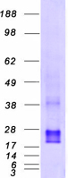 CDC42 Protein - Purified recombinant protein CDC42 was analyzed by SDS-PAGE gel and Coomassie Blue Staining