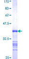 CDC42BPA / MRCK Protein - 12.5% SDS-PAGE Stained with Coomassie Blue.