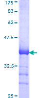 CDC42BPB / MRCKB Protein - 12.5% SDS-PAGE Stained with Coomassie Blue.