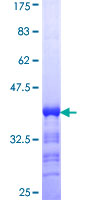 CDC42BPG Protein - 12.5% SDS-PAGE Stained with Coomassie Blue.