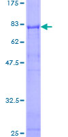 CDC42EP1 / CEP1 Protein - 12.5% SDS-PAGE of human CDC42EP1 stained with Coomassie Blue