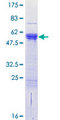 CDC42EP2 Protein - 12.5% SDS-PAGE of human CDC42EP2 stained with Coomassie Blue