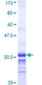 CDC42EP3 Protein - 12.5% SDS-PAGE Stained with Coomassie Blue.