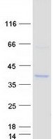 CDC42EP3 Protein - Purified recombinant protein CDC42EP3 was analyzed by SDS-PAGE gel and Coomassie Blue Staining