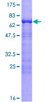 CDC42EP4 / BORG4 Protein - 12.5% SDS-PAGE of human CDC42EP4 stained with Coomassie Blue