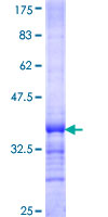 CDC42SE2 Protein - 12.5% SDS-PAGE Stained with Coomassie Blue.