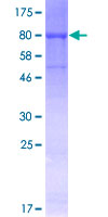 CDC45 Protein - 12.5% SDS-PAGE of human CDC45L stained with Coomassie Blue