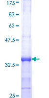 CDC45 Protein - 12.5% SDS-PAGE Stained with Coomassie Blue.