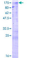CDC5 / CDC5L Protein - 12.5% SDS-PAGE of human CDC5L stained with Coomassie Blue
