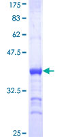 CDC5 / CDC5L Protein - 12.5% SDS-PAGE Stained with Coomassie Blue.