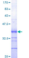 CDC6 Protein - 12.5% SDS-PAGE Stained with Coomassie Blue.