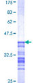 CDC7 Protein - 12.5% SDS-PAGE Stained with Coomassie Blue.