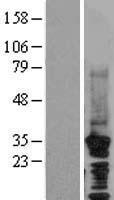 CDC73 / Parafibromin Protein - Western validation with an anti-DDK antibody * L: Control HEK293 lysate R: Over-expression lysate
