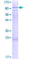 CDC73 / Parafibromin Protein - 12.5% SDS-PAGE of human CDC73 stained with Coomassie Blue