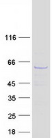 CDC73 / Parafibromin Protein - Purified recombinant protein CDC73 was analyzed by SDS-PAGE gel and Coomassie Blue Staining