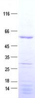 CDCA1 / NUF2 Protein