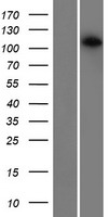 CDCA2 Protein - Western validation with an anti-DDK antibody * L: Control HEK293 lysate R: Over-expression lysate