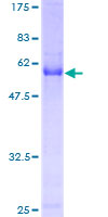 CDCA3 Protein - 12.5% SDS-PAGE of human CDCA3 stained with Coomassie Blue