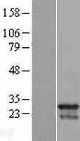 CDCA4 Protein - Western validation with an anti-DDK antibody * L: Control HEK293 lysate R: Over-expression lysate