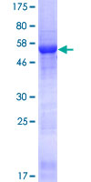 CDCA4 Protein - 12.5% SDS-PAGE of human CDCA4 stained with Coomassie Blue