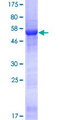 CDCA4 Protein - 12.5% SDS-PAGE of human CDCA4 stained with Coomassie Blue
