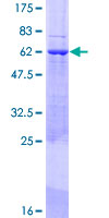 CDCA5 / Sororin Protein - 12.5% SDS-PAGE of human CDCA5 stained with Coomassie Blue