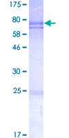 CDCA7 Protein - 12.5% SDS-PAGE of human CDCA7 stained with Coomassie Blue