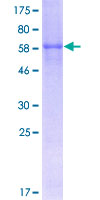 CDCP1 Protein - 12.5% SDS-PAGE of human CDCP1 stained with Coomassie Blue