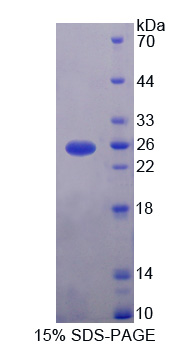 CDCP1 Protein - Recombinant  CUB Domain Containing Protein 1 By SDS-PAGE