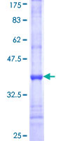 CDG1C / ALG6 Protein - 12.5% SDS-PAGE Stained with Coomassie Blue.