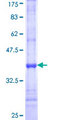 CDG1C / ALG6 Protein - 12.5% SDS-PAGE Stained with Coomassie Blue.