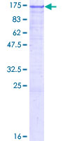 CDH1 / E Cadherin Protein - 12.5% SDS-PAGE of human CDH1 stained with Coomassie Blue