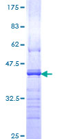 CDH1 / E Cadherin Protein - 12.5% SDS-PAGE Stained with Coomassie Blue.