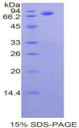 CDH1 / E Cadherin Protein - Recombinant Cadherin, Epithelial By SDS-PAGE