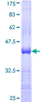 CDH11 / Cadherin 11 Protein - 12.5% SDS-PAGE Stained with Coomassie Blue.