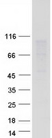 CDH11 / Cadherin 11 Protein - Purified recombinant protein CDH11 was analyzed by SDS-PAGE gel and Coomassie Blue Staining