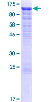 CDH12 / Cadherin 12 Protein - 12.5% SDS-PAGE of human CDH12 stained with Coomassie Blue