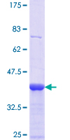 CDH12 / Cadherin 12 Protein - 12.5% SDS-PAGE Stained with Coomassie Blue.
