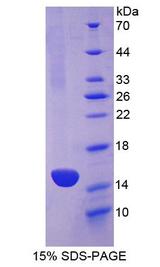 CDH13 / Cadherin 13 Protein - Recombinant  Cadherin, Heart By SDS-PAGE